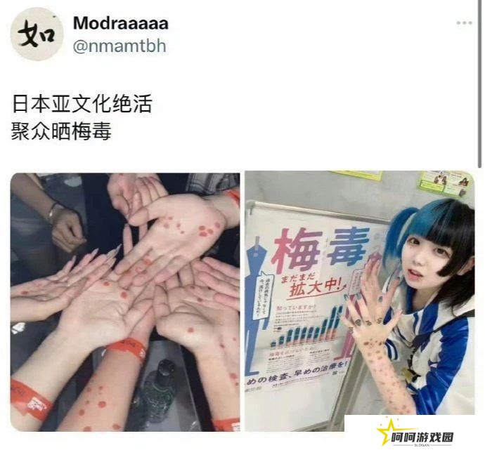 PS5涨价与小日子梅毒激增 背后潜藏着一样的逻辑